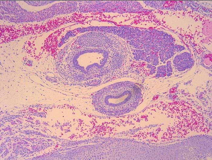 Image of Mouse embryo_E15_thyroid